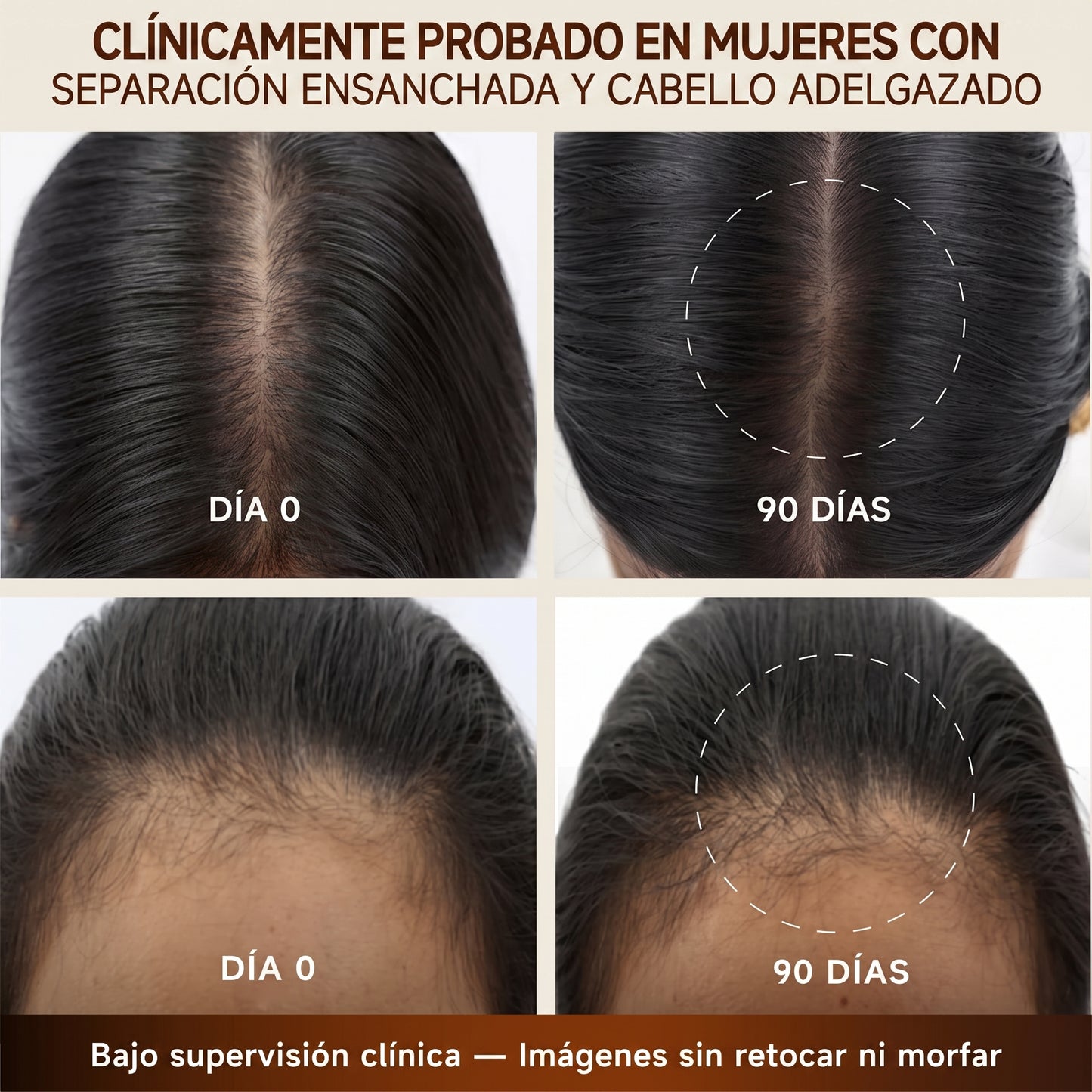 Capileka® Suero Capilar · Tratamiento Ayurvédico 30ml