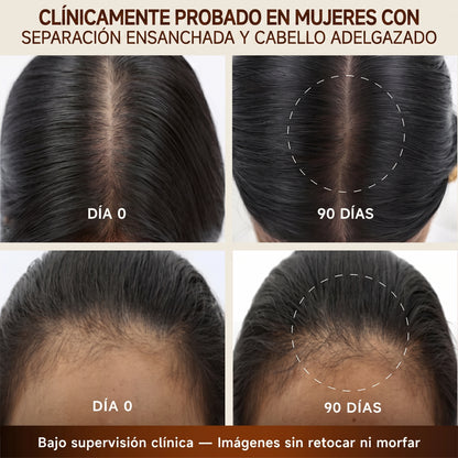 Capileka® Suero Capilar · Tratamiento Ayurvédico 30ml