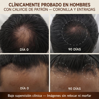 Capileka® Suero Capilar · Tratamiento Ayurvédico 30ml