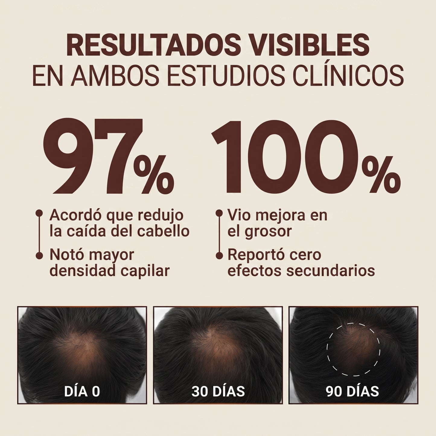Capileka® Suero Capilar · Tratamiento Ayurvédico 30ml