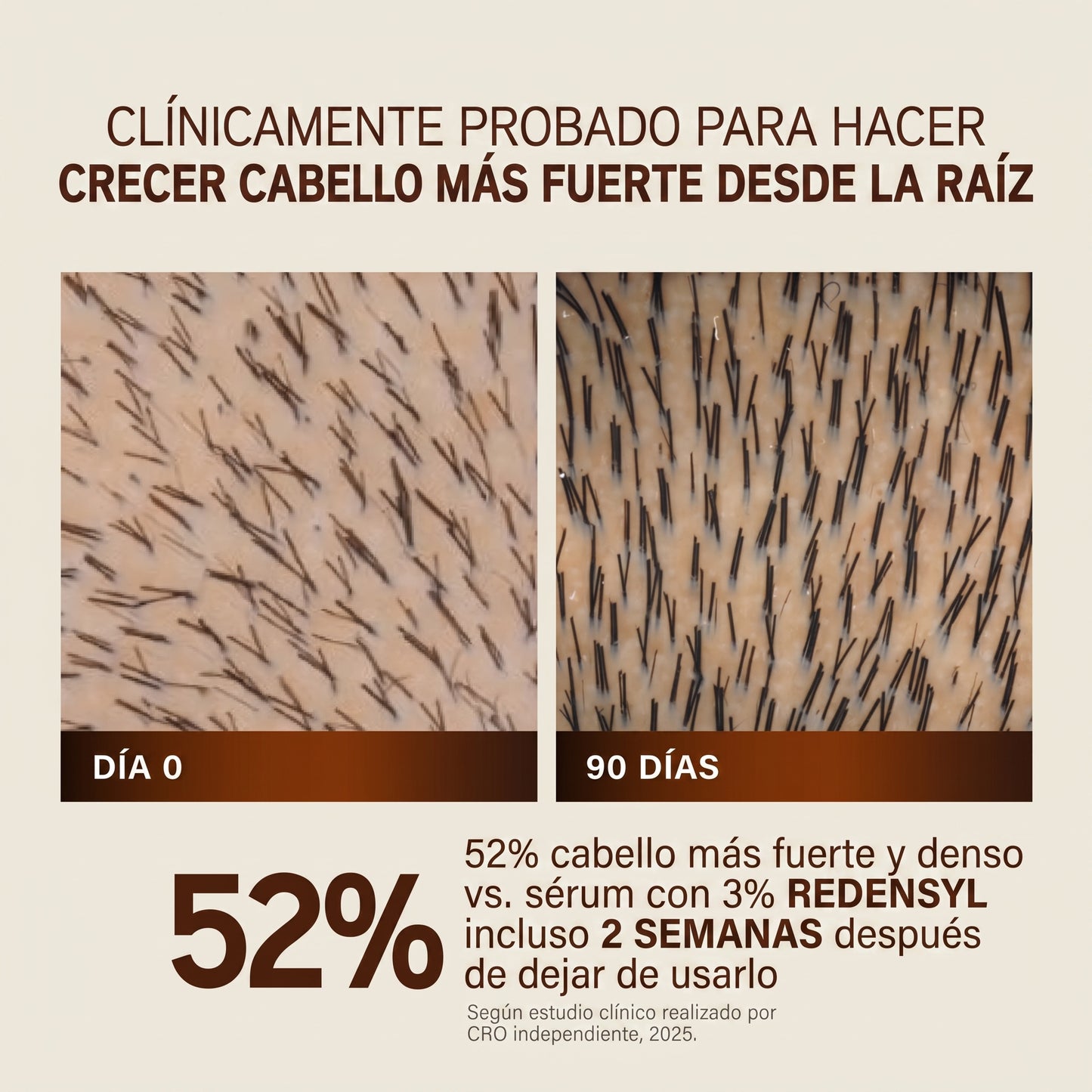 Capileka® Suero Capilar · Tratamiento Ayurvédico 30ml
